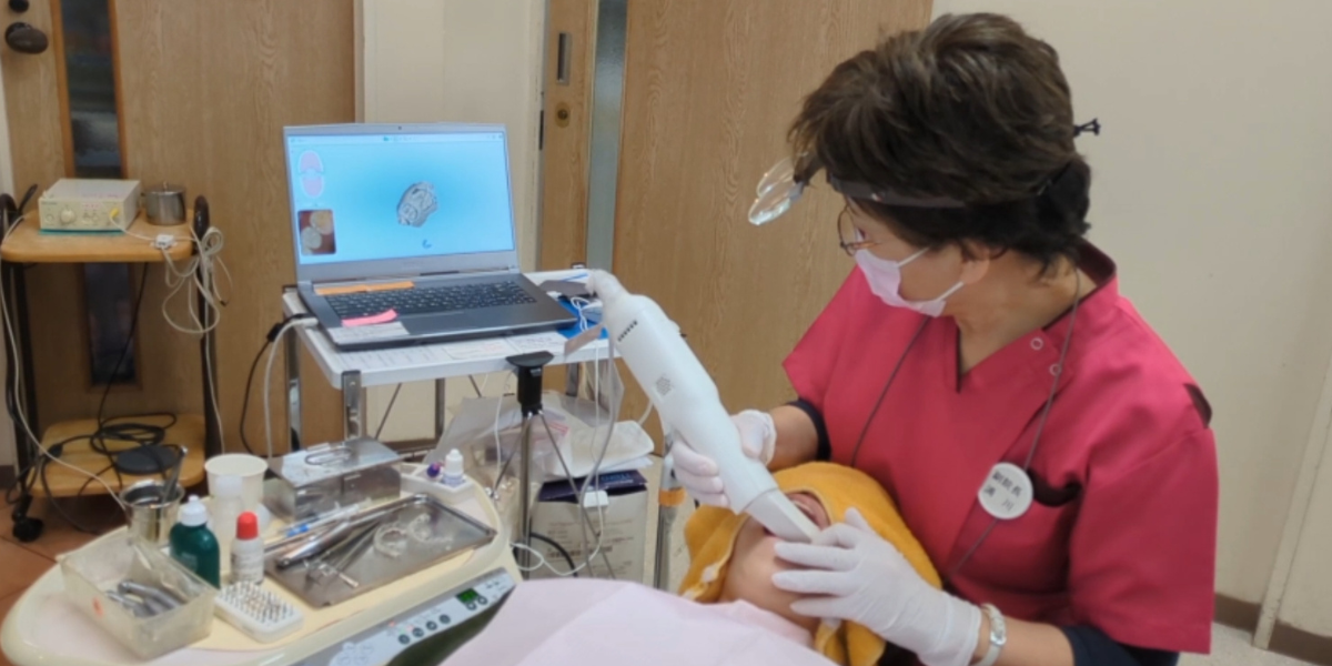 口腔内をカメラで撮影するだけの最新の型採り